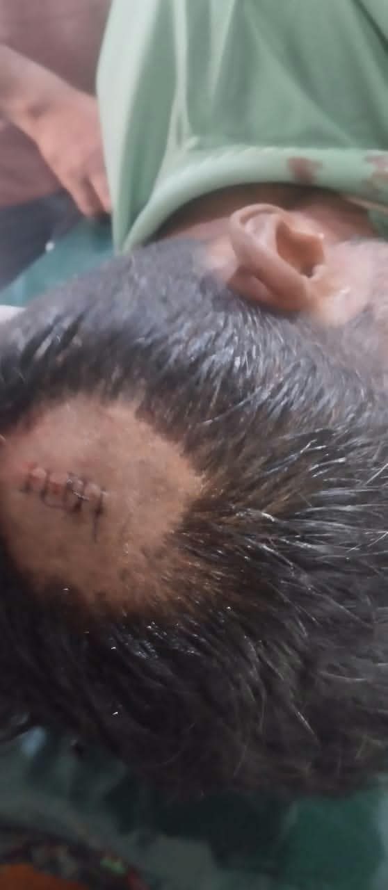 ভুরুঙ্গামারীতে জমি দখলের চেষ্টায় হামলায় আহত-১